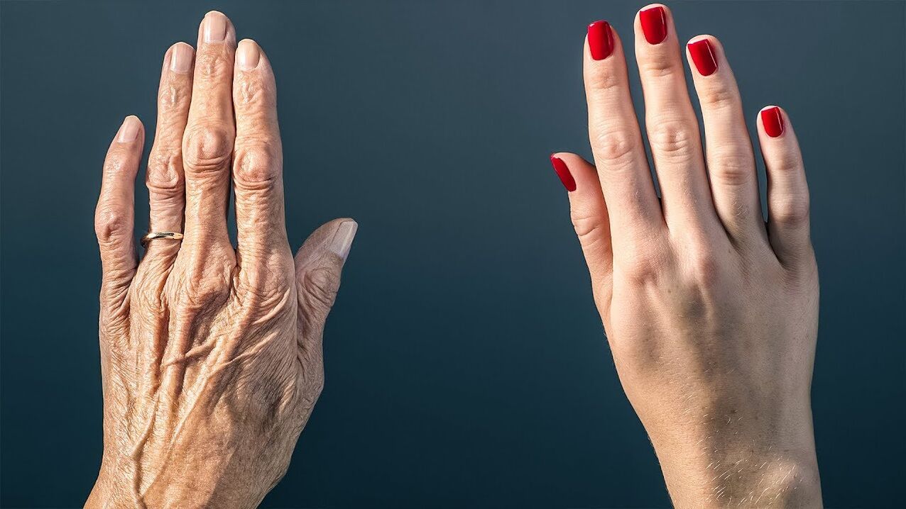 Formas efectivas de rejuvenecer la piel de las manos.