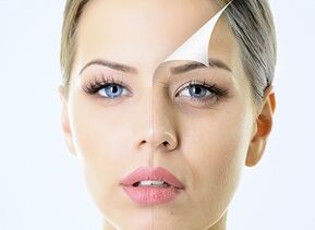 Cómo rejuvenecer la piel alrededor de los ojos en casa.